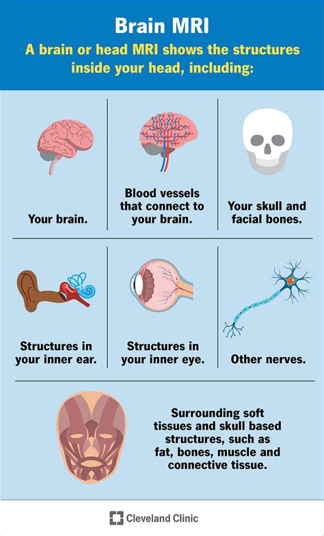 Brain MRI: What It Is, Purpose, Procedure & Results .